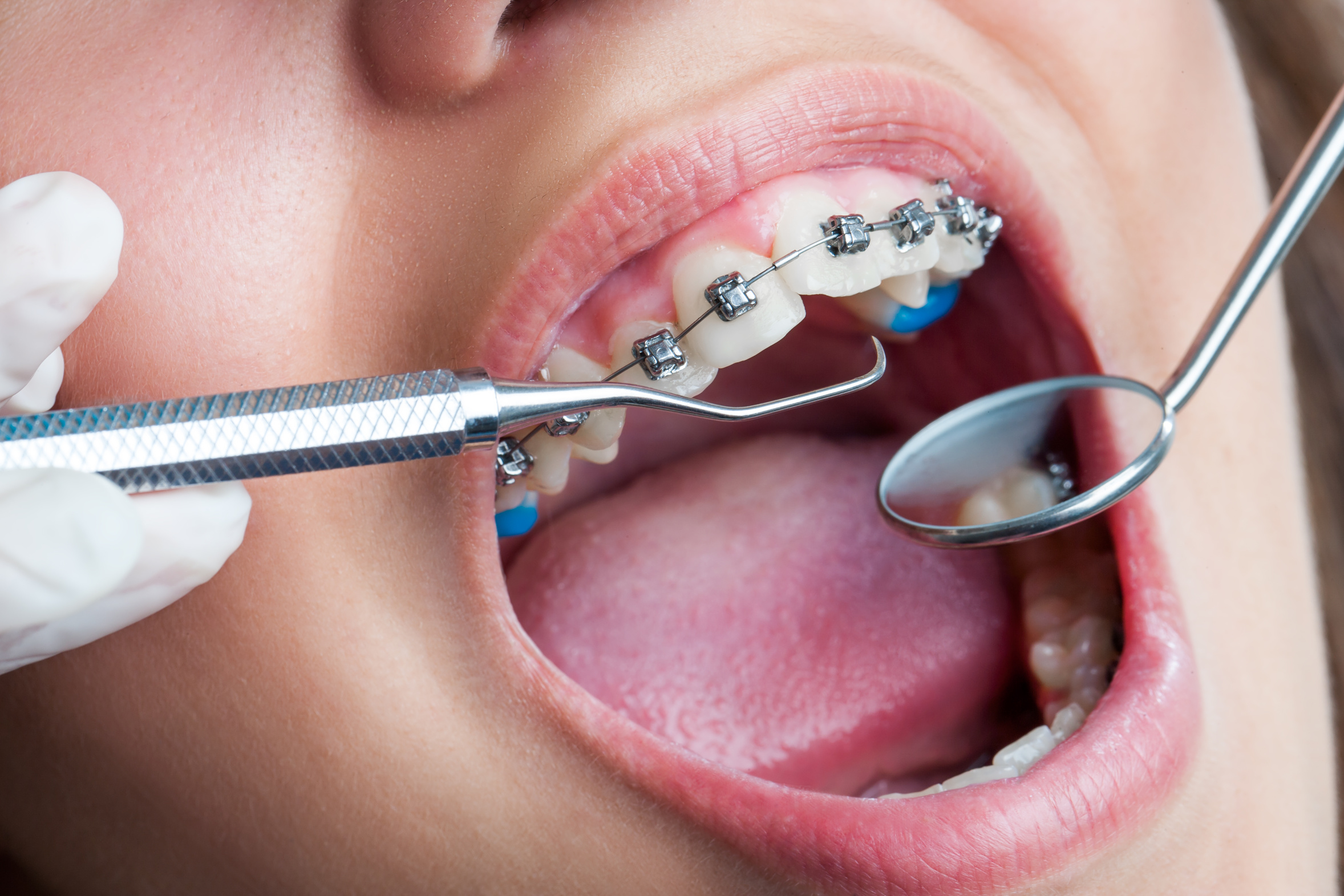 ortodoncja-vdentvdent